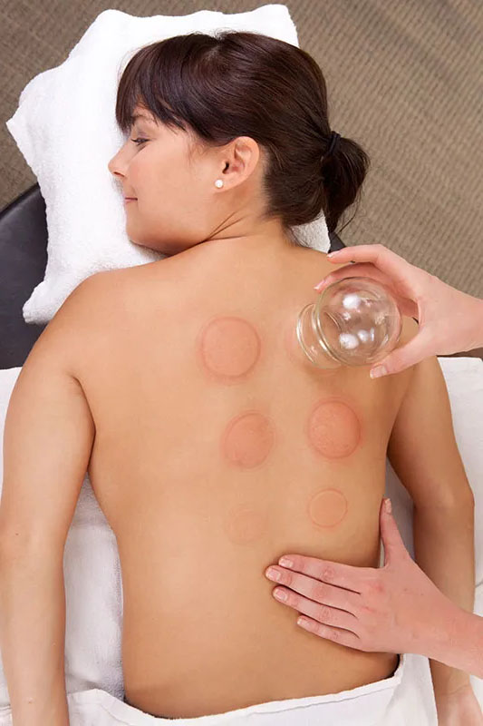 Cupping massage bovenlichaam